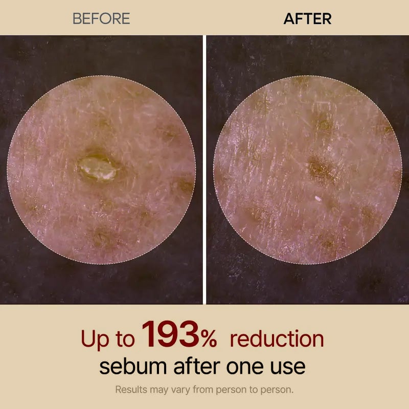 Gentle Exfoliating Ampoule – Black Rice