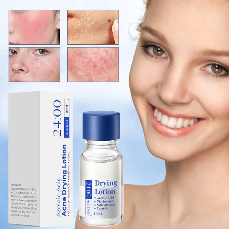 Salicylic Acid Anti-Acne Essence