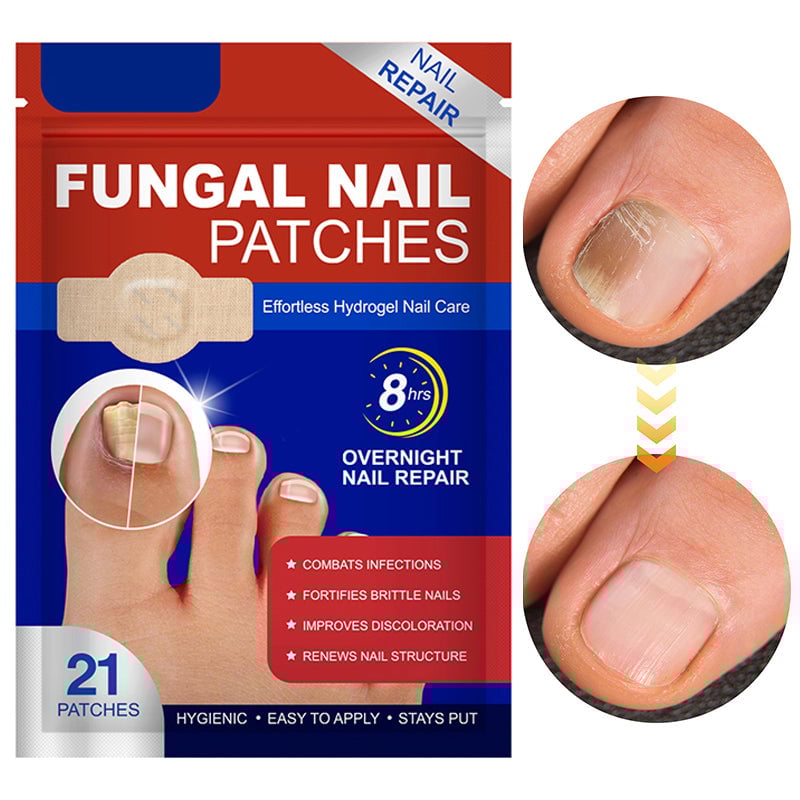 Fungal Nail Patches