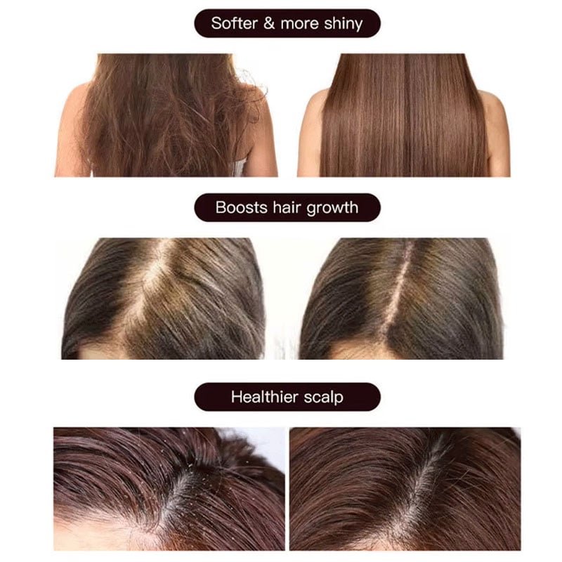 Rosemary Scalp Hair Elixir