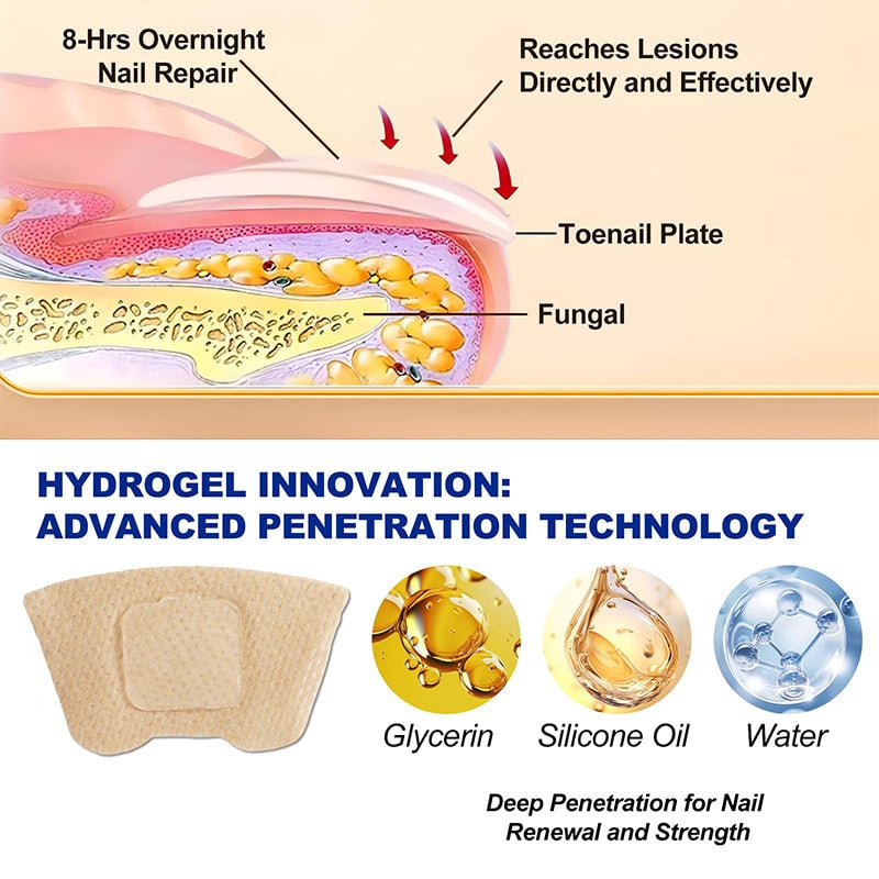 Fungal Nail Patches