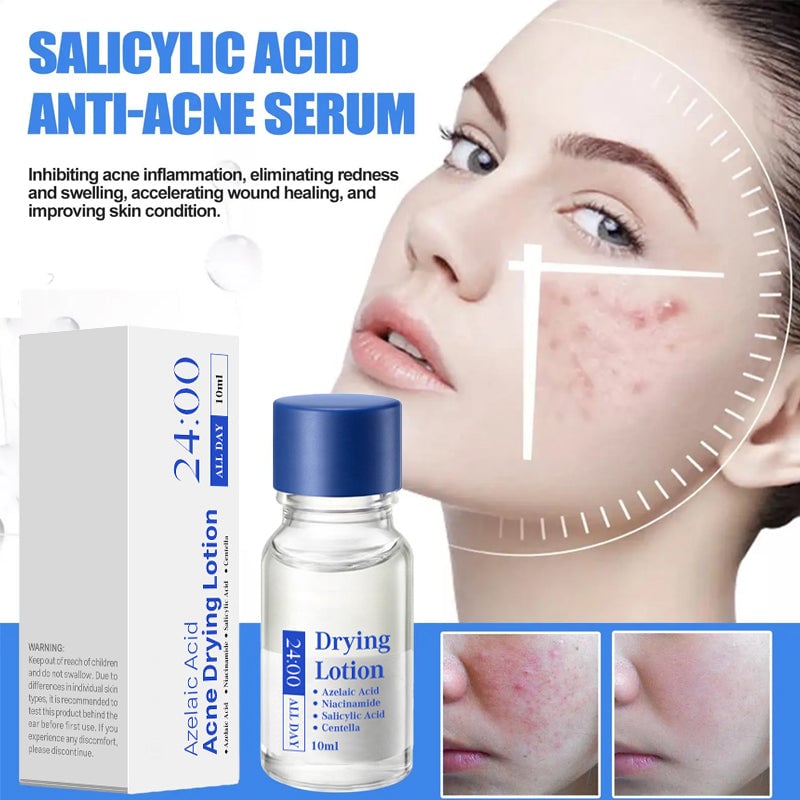 Salicylic Acid Anti-Acne Essence