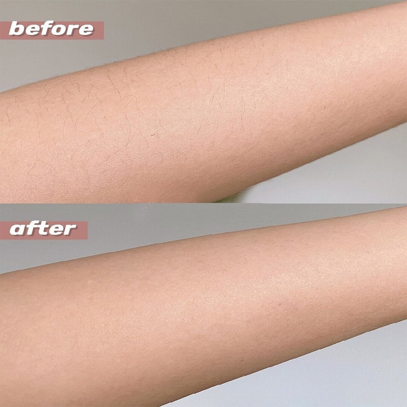 2-in-1 Rechargeable Gentle Facial & Body Epilator