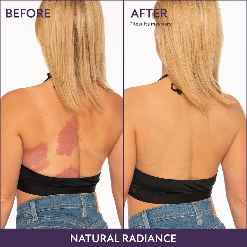 Body Coverage Perfector – Waterproof Leg & Body Makeup