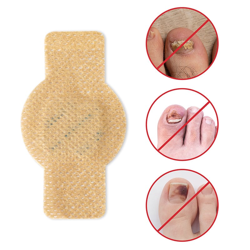 Fungal Nail Patches