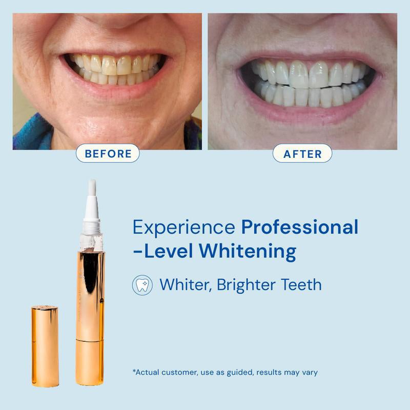 Extra-Strength Teeth Whitening Serum Oral Care