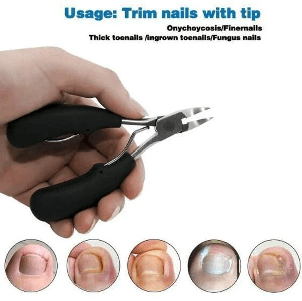 （50%OFF TODAY）  Medical-Grade Nail Clippers